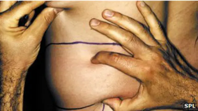 ब्रिटेन में 40 हजार महिलाओं ने ब्रेस्ट इम्प्लांट कराया है.