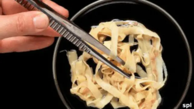 Ленточные черви