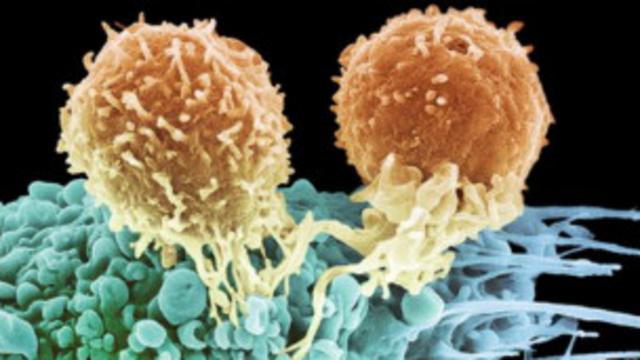Células T atacando cáncer
