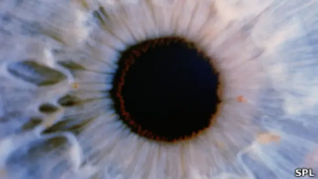 Ojo