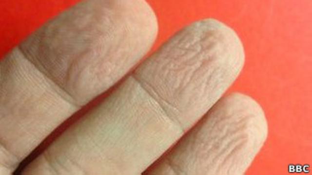 Ученые выяснили, почему кожа на пальцах сморщивается в воде - Российская газета
