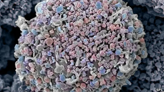 Células cancerígenas