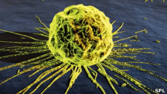 يخفض الفحص الجيني احتمال الإصابة بنسبة تسعين في المائة 