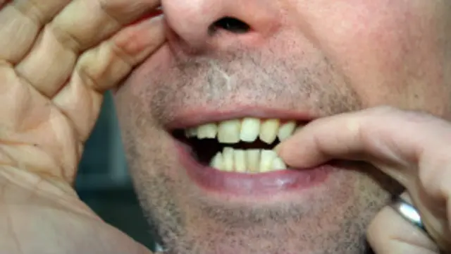 सिल्बो में विभिन्न ध्वनियों के सहारे अपनी बात पहुंचाई जाती है