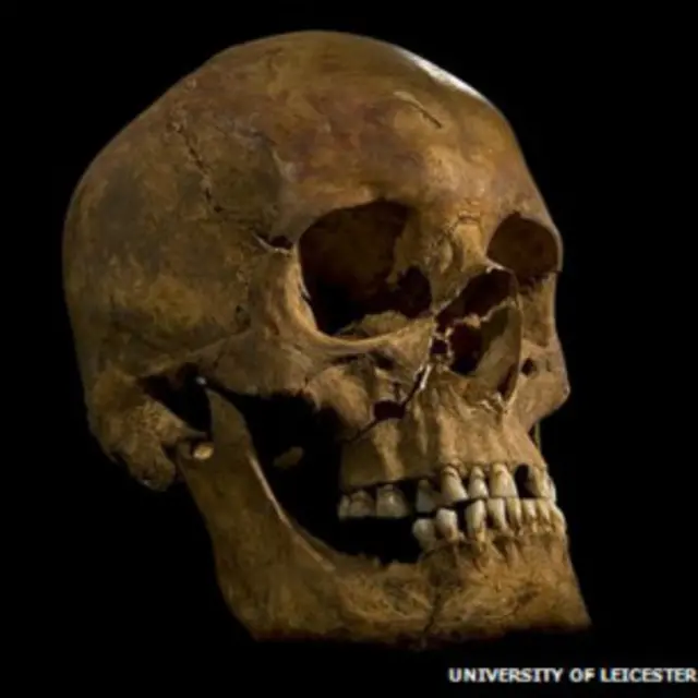 Tengkorak Raja Richard III