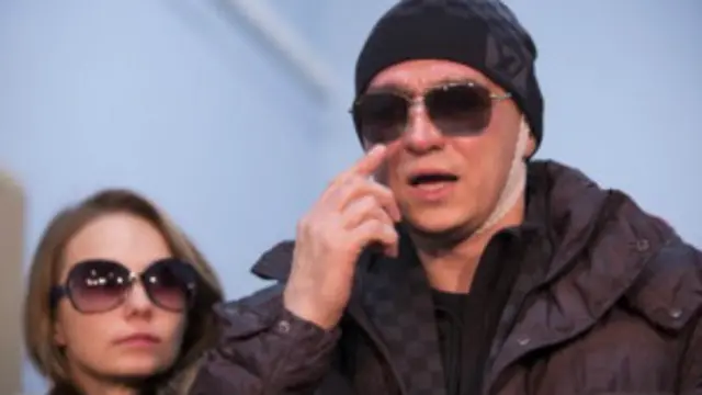 سيرجي،فرقة،البالية،روسيا،