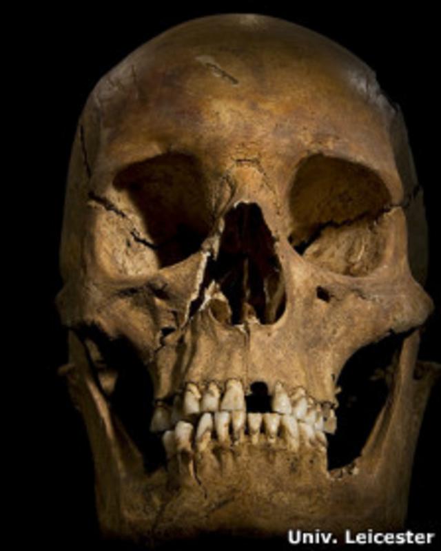 Cráneo de Ricardo III