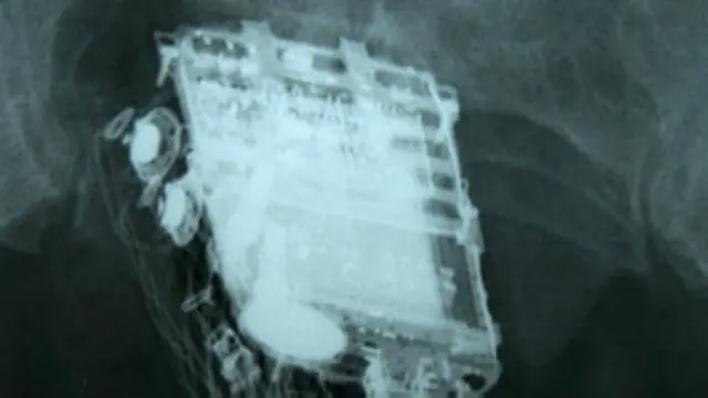 صورة الأشعة تكشف موقع الهاتف النقال