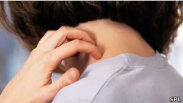 Ver a otra persona rascarse, nos induce a rascarnos a nosotros mismos.