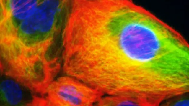 Cutar cancer ko kuma daji