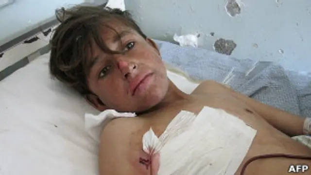 Афганский раненый мальчик