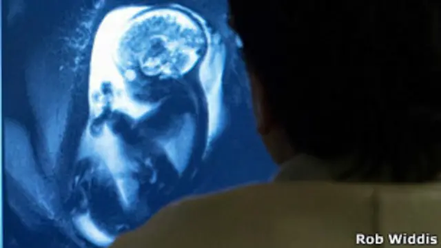 Escáner cerebral de un feto (Foto: Rob Widdis)