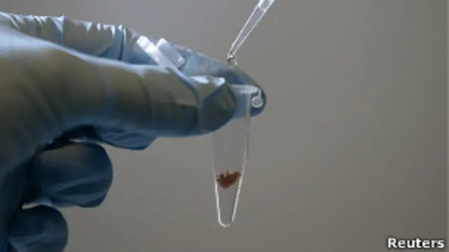 د څېړونکو په وینا د ماشومانو په لا سونو، پښو او خولو کې میکروبونه زياتې ناروغۍ رامنځ ته کوي.