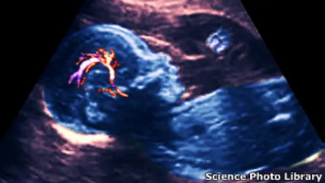 Feto en el útero