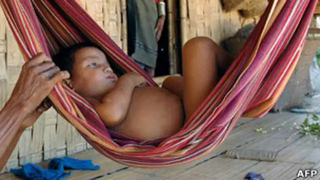 Niño con malaria