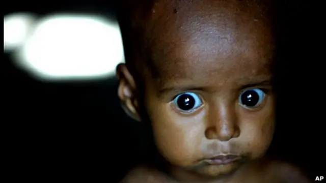 "ලංකාවේ මවුවරුන්ගේ පෝෂණය අඩුවීමත්, ඒ අයගේ මිටි භාවයත් නිසා ළමුන් සියයට 16 ක් ඉපදෙන්නේ අඩු බරින්"