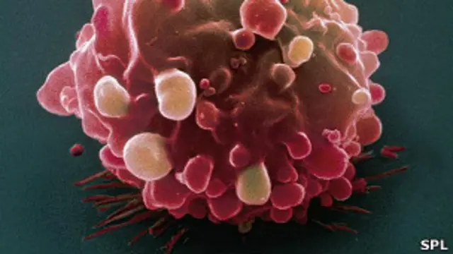 Célula cancerígena de colon