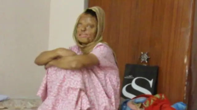 सोनाली पर 17 साल की उम्र में हमला हुआ था