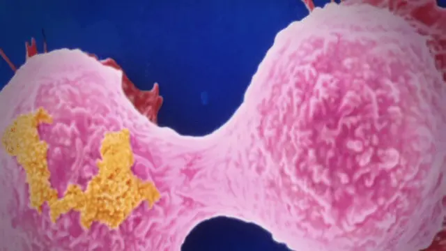 سلول‌های سرطانی معده