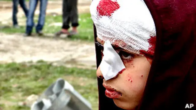 المدنيون اكثر ضحايا الصراع في سوريا