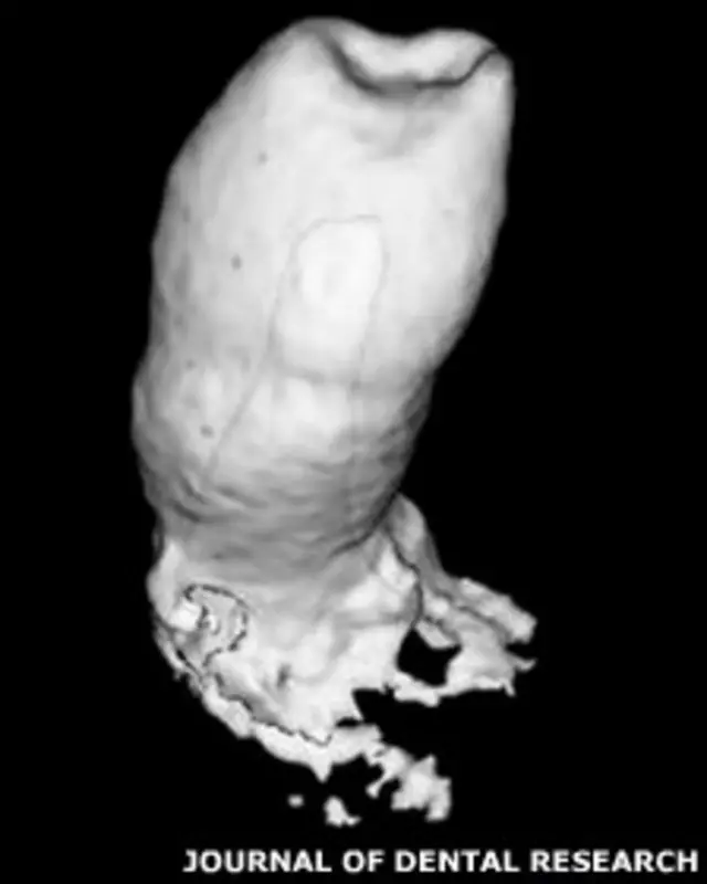 Выращенный человеко-мышиный зуб