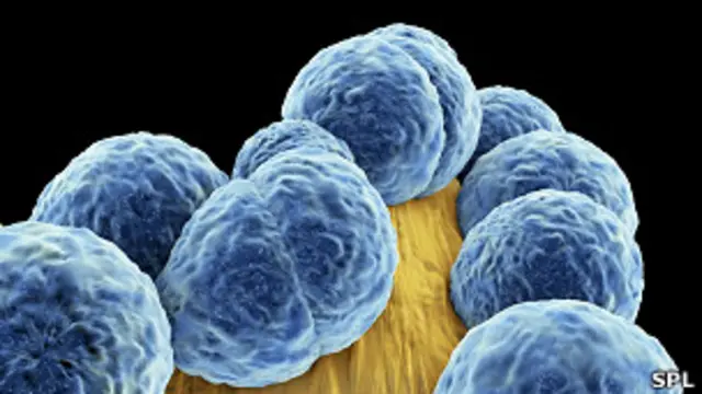 SARM,cepa de la bacteria Staphylococcus aureus