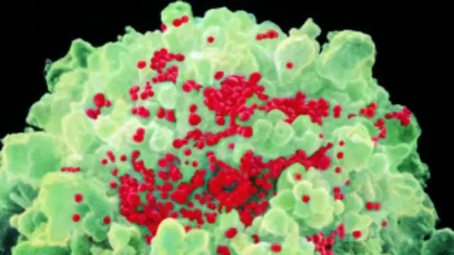 Virus HIV tấn công hệ miễn dịch