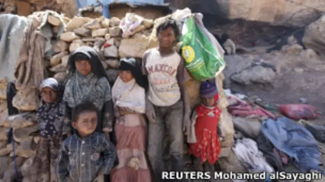 الأطفال في اليمن محاصرون بالصراعات والجوع وتدني الخدمات الصحية والاجتماعية