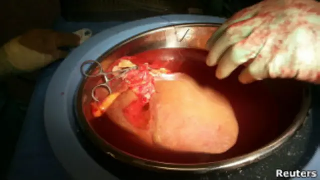 Fígado | Foto: Reuters