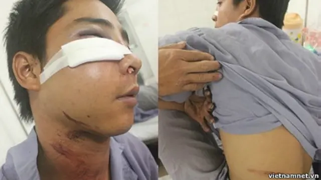 Nạn nhân Nghiêm Duy Hoàng