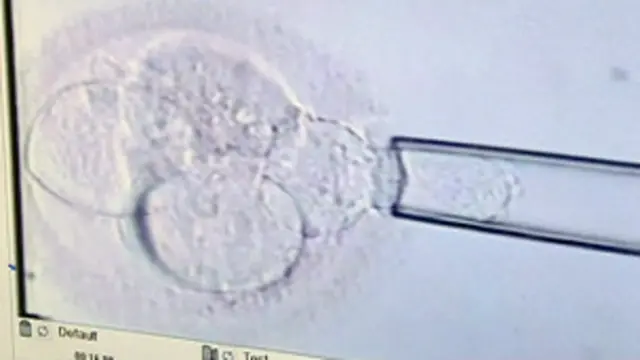 Inseminación artificial