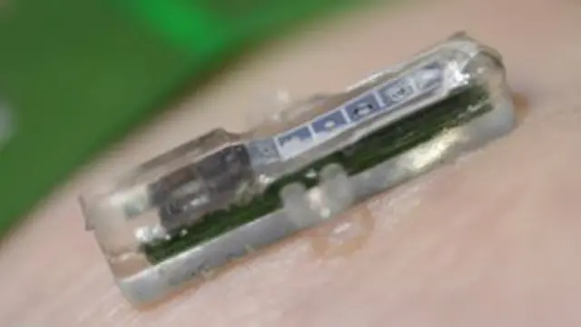 анализ крови, прибор