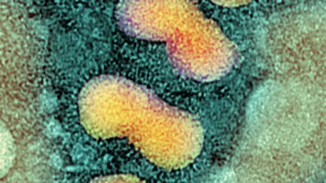 فيروس انفلونزا الطيور 