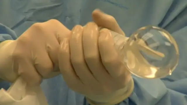 روش جدید کار گذاشتن پروتز پستان