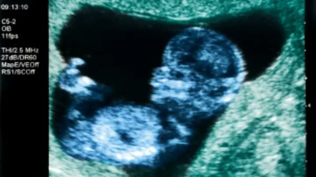 عکس آرشیوی است