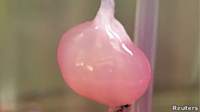 பரிசோதனைக் கூடத்தில் வளர்ந்த சிறுநீரகம் ஓர் உயிரினத்தில் பொருத்தப்பட்டு தொழிற்படுகின்ற முதல்சந்தர்ப்பம் இது