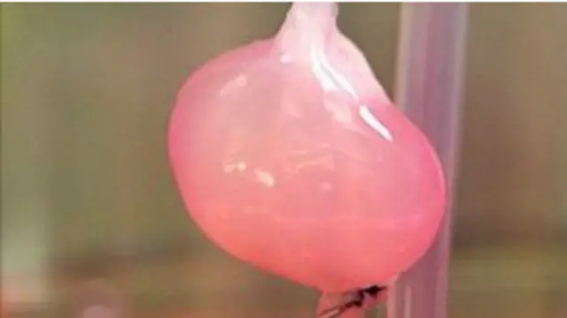 လူ ဖန်တီးယူတဲ့ ကျောက်ကပ်