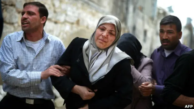 جريحة سورية في حلب