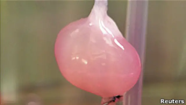 Искусственная почка