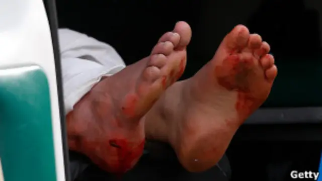 تعداد مجروحان تا یک صد و سی نفر گزارش شده اند