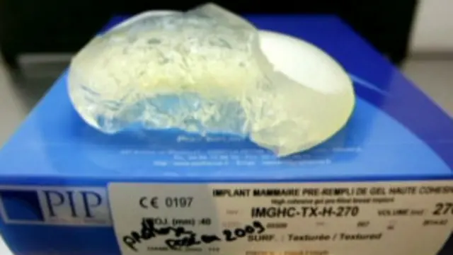 ब्रेस्ट इम्प्लांट