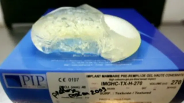 وقعت الكثير من حالات التمزق في الأثداء الصناعية المعيبة.