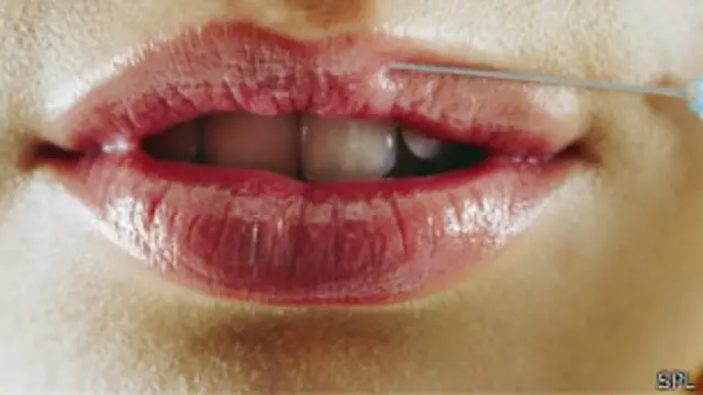 Nhiều người bơm chất Botox để xóa nếp nhăn hoặc cho môi đầy đặn hơn