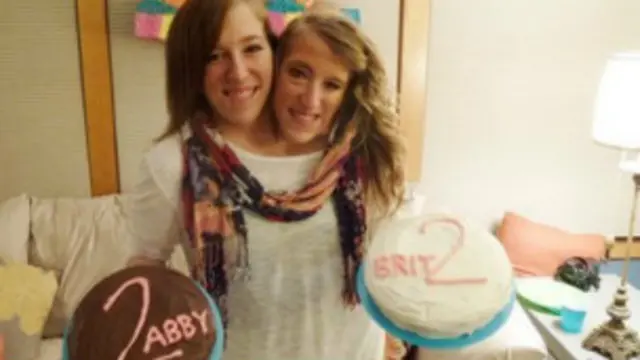 जुड़ी हुई जुड़वा बहनें 