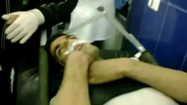 Шифокорлар қурбонлар аломатларидан зарин гази қўлланганига кучли ишора борлигини айтганлар