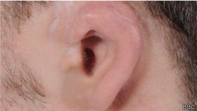 orelhadownload apk betanoBrian Hogg (foto: BBC)