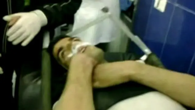 अमरीका ने नर्वस सिस्टम को प्रभावित करने वाले सरीन के “सीमित इस्तेमाल' की बात कही है.