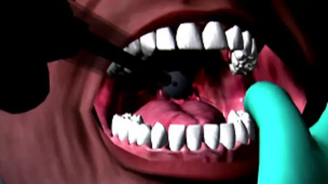 Imagem digital de boca aberta com injeção (crédito: BBC)