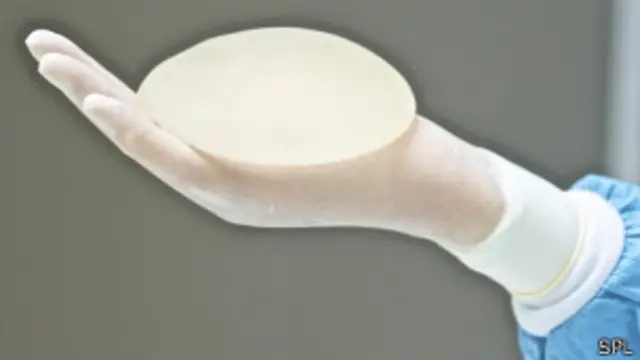 prótese de silicone (foto:SPL)