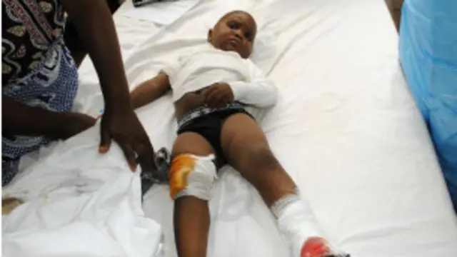 أصيب أكثر من 50 شخصا في الانفجار. 